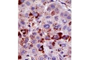 Image no. 2 for anti-Small Ubiquitin Related Modifier Protein 1 (SUMO1) antibody (ABIN356808)