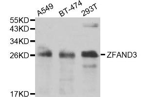 Western blot analysis of extracts of various cell lines, using ZFAND3 antibody (ABIN5975562) at 1/1000 dilution. (ZFAND3 抗体)