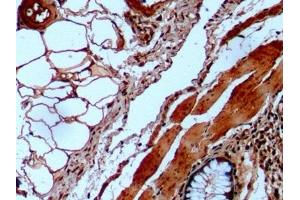 Detection of GLa in Human Colon Tissue using Monoclonal Antibody to Galactosidase Alpha (GLa)
