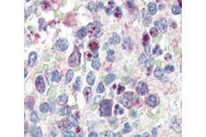 IHC analysis of FFPE human spleen tissue stained with anti-SNAIL antibody (SNAIL 抗体  (AA 9-39))