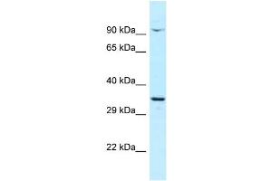 Host: Rabbit Target Name: CTNNBL1 Sample Type: OVCAR-3 Whole Cell lysates Antibody Dilution: 1. (CTNNBL1 抗体  (C-Term))