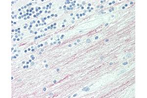 Anti-CPT1C antibody IHC staining of human brain, cerebellum, white matter. (CPT1C 抗体  (AA 752-782))