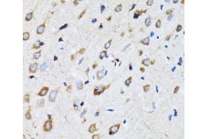 Immunohistochemistry of paraffin-embedded Rat brain using NDE1 Polyclonal Antibody at dilution of 1:100 (40x lens). (NDE1 抗体)