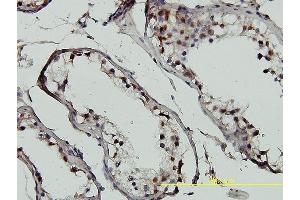 Immunostaining (ISt) image for anti-General Transcription Factor IIH, Polypeptide 1, 62kDa (GTF2H1) (AA 1-548) antibody (ABIN561177)
