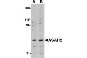Western Blotting (WB) image for anti-N-Acylsphingosine Amidohydrolase (Non-Lysosomal Ceramidase) 2 (ASAH2) (C-Term) antibody (ABIN1030258) (ASAH2 抗体  (C-Term))