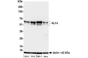 Western Blotting (WB) image for anti-Kruppel-Like Factor 4 (Gut) (KLF4) (AA 75-125) antibody (ABIN7795639) (Recombinant KLF4 抗体  (AA 75-125))