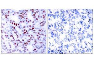 Immunohistochemistry (IHC) image for anti-Jun Proto-Oncogene (JUN) (Ser243) antibody (ABIN1848120) (C-JUN 抗体  (Ser243))