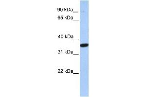 MOGAT1 antibody used at 1 ug/ml to detect target protein.