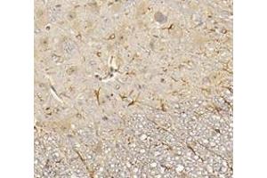 Immunohistochemistry analysis of paraffin-embedded mouse spinal cord using,CHERP (ABIN7073277) at dilution of 1: 3600 (CHERP 抗体)