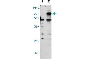 Western blot analysis of CPT1B (arrow) using rabbit CPT1B polyclonal antibody . (CPT1B 抗体  (C-Term))