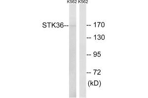 Western blot analysis of extracts from K562 cells, using STK36 antibody. (STK36 抗体  (Internal Region))