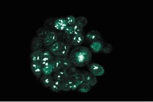 Immunofluorescence staining of WiDr cells (Human colorectal adenocarcinoma, ATCC CCL-218).