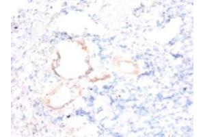 Immunohistochemistry of paraffin-embedded human kidney tissue using ABIN7143861 at dilution of 1:50 (Ensa 抗体  (AA 1-121))