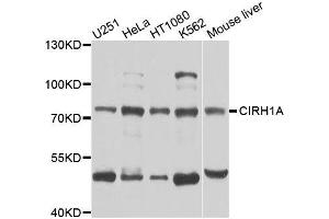 Western blot analysis of extracts of various cell lines, using CIRH1A antibody (ABIN5996208) at 1/1000 dilution. (CIRH1A 抗体)