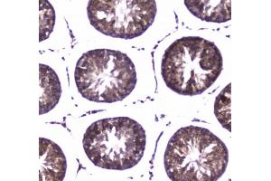 IHC testing of FFPE rat tesis tissue with WWOX antibody at 1ug/ml. (WWOX 抗体)