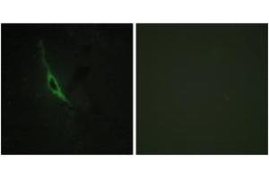 Immunofluorescence analysis of NIH-3T3 cells, using GRAK Antibody. (GZMK 抗体  (AA 61-110))