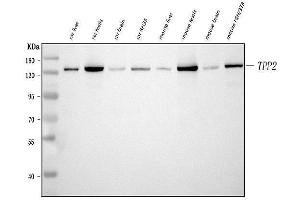 Western blot analysis of Tripeptidyl peptidase II/TPPII/TPP2 using anti-Tripeptidyl peptidase II/TPPII/TPP2 antibody (ABIN7601293).