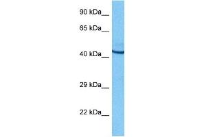 Host:  Rat  Target Name:  POU2F3  Sample Tissue:  Rat Brain  Antibody Dilution:  1ug/ml (POU2F3 抗体  (N-Term))