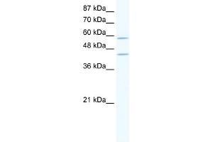 WB Suggested Anti-DCP1A Antibody Titration:  2. (DCP1A 抗体  (N-Term))