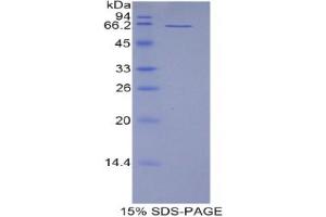 SDS-PAGE analysis of Mouse CD5L Protein. (CD5L 蛋白)