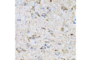 Immunohistochemistry of paraffin-embedded mouse spinal cord using HSPA9 antibody. (HSPA9 抗体  (AA 380-679))