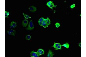 Immunofluorescent analysis of MCF-7 cells using ABIN7163824 at dilution of 1:100 and Alexa Fluor 488-congugated AffiniPure Goat Anti-Rabbit IgG(H+L) (PKD1L2 抗体  (AA 1-306))