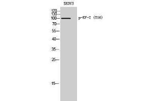 Western Blotting (WB) image for anti-Eukaryotic Translation Elongation Factor 2 (EEF2) (pThr56) antibody (ABIN3182747) (EEF2 抗体  (pThr56))