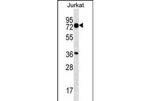 PLS1 Antibody (C-term) (ABIN657071 and ABIN2846234) western blot analysis in Jurkat cell line lysates (35 μg/lane). (PLS1 抗体  (C-Term))
