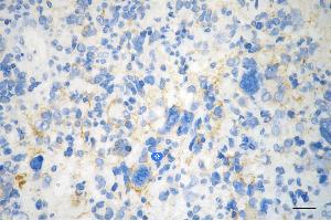 anti-Melanoma Antigen Family D, 1 (MAGED1) antibody