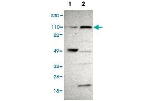 Western Blot analysis of (1) Human RT-4 cell, (2) Human U-251MG sp cell. (PAX3 and PAX7 Binding Protein 1 (PAXBP1) 抗体)