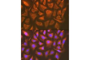 Immunofluorescence analysis of U-2 OS cells using U Rabbit mAb (ABIN7271211) at dilution of 1:100 (40x lens). (UAP1 抗体)