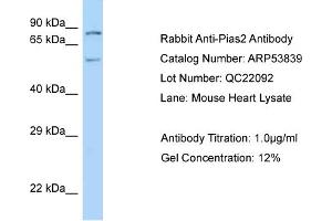 Western Blotting (WB) image for anti-Protein Inhibitor of Activated STAT, 2 (PIAS2) (N-Term) antibody (ABIN2785609)