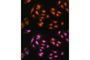 Immunofluorescence analysis of U2OS cells using  Rabbit pAb (ABIN1678593, ABIN3018971, ABIN3018972 and ABIN6220651) at dilution of 1:100. (ADRM1 抗体  (AA 108-407))