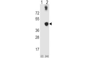Western Blotting (WB) image for anti-Alcohol Dehydrogenase 5 (Class III), chi Polypeptide (ADH5) antibody (ABIN3003804) (ADH5 抗体)