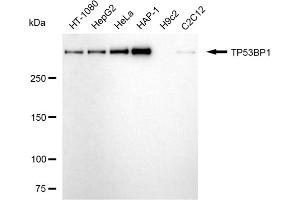 Western blotting analysis using TP53BP1 antibody (ABIN7800690). (TP53BP1 抗体)