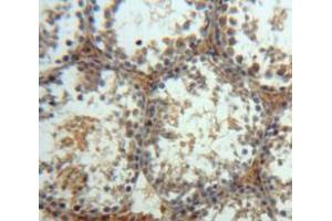 Used in DAB staining on fromalin fixed paraffin-embedded Testis tissue (MAPK10 抗体  (AA 88-332))