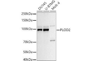 Western blot analysis of extracts of various cell lines, using PLOD2/LH2 antibody (ABIN6132888, ABIN6145788, ABIN6145790 and ABIN6222693) at 1:1000 dilution. (PLOD2 抗体  (AA 470-650))