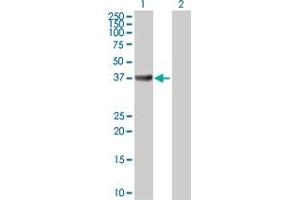 Western Blot analysis of ADA expression in transfected 293T cell line by ADA MaxPab polyclonal antibody. (ADA 抗体  (AA 1-363))