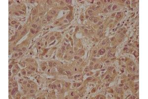 Immunohistochemistry (IHC) image for anti-Son of Sevenless Homolog 2 (SOS2) (AA 187-404) antibody (ABIN7170322)