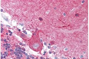 Human Brain, Cerebellum (formalin-fixed, paraffin-embedded) stained with STMN1 antibody ABIN214065 at 10 ug/ml followed by biotinylated goat anti-rabbit IgG secondary antibody ABIN481713, alkaline phosphatase-streptavidin and chromogen.