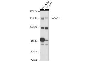 Western blot analysis of extracts of various cell lines, using CE antibody (ABIN3015546, ABIN3015547, ABIN3015548 and ABIN6218802) at 1:1000 dilution. (CEACAM1 抗体  (AA 300-430))