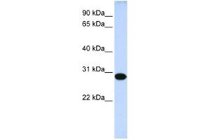 WB Suggested Anti-DRGX Antibody Titration:  0. (DRGX 抗体  (Middle Region))