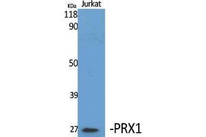Western Blotting (WB) image for anti-Paired Related Homeobox 1 (PRRX1) (Internal Region) antibody (ABIN3186573) (PRRX1 抗体  (Internal Region))