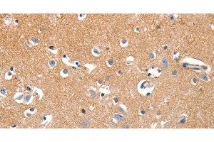 Immunohistochemistry of paraffin-embedded Human brain tissue using LRP3 Polyclonal Antibody at dilution 1:80 (LRP3 抗体)
