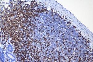 IHC analysis of CD5 using anti-CD5 antibody (ABIN7600839). (CD5 抗体  (AA 24-494))