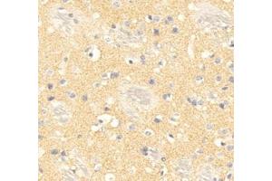 Immunohistochemistry analysis of paraffin embedded mouse brain using PPP2R2C (ABIN7075278) at dilution of 1: 500 (PPP2R2C 抗体)