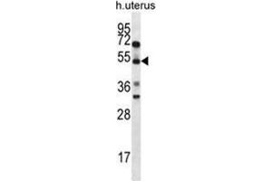 ABRA Antibody (C-term) western blot analysis in human normal Uterus cell line lysates (35ug/lane). (ABRA 抗体  (C-Term))