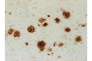 Immunostaining of paraffin embedded brain section from an Alzheimer´s patient (dilution 1 : 500). (Abeta 38/40/42 (AA 1-16), (AA 4-16) 抗体)