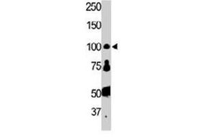 The FER polyclonal antibody  is used in Western blot to detect FER in HL-60 cell lysate. (FER 抗体  (AA 789-818))