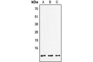 Western blot analysis of FXYD2 expression in HepG2 (A), mouse lung (B), rat brain (C) whole cell lysates. (FXYD2 抗体  (C-Term))